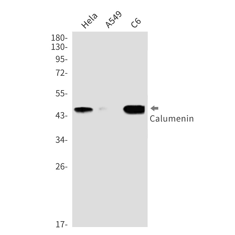 Calumenin (14E19) Rabbit Monoclonal Antibody