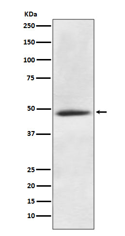 CaMKII alpha (11L11) Rabbit Monoclonal Antibody