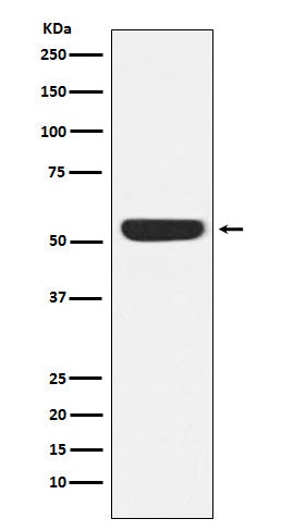 CAMKIV (19K4) Rabbit Monoclonal Antibody
