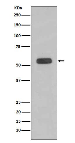 Caspase-8 (3Q3) Rabbit Monoclonal Antibody