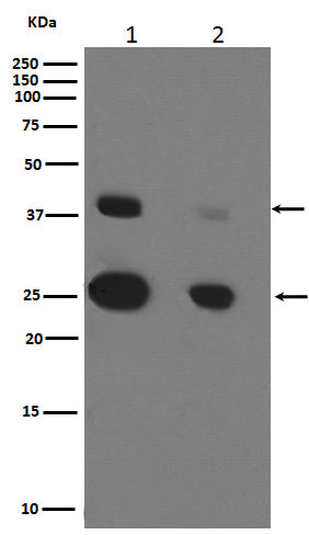 Cathepsin D (11F19) Rabbit Monoclonal Antibody
