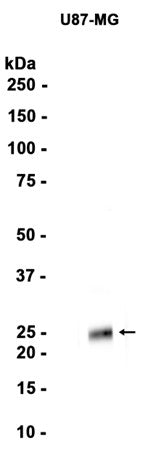 Cathepsin S (16H3) Rabbit Monoclonal Antibody