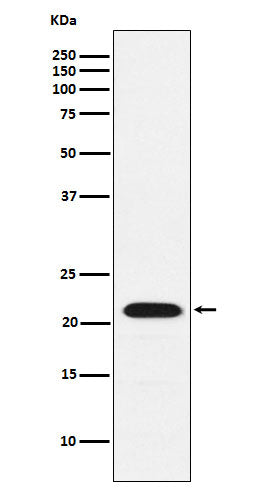 CBFb (14H12) Rabbit Monoclonal Antibody