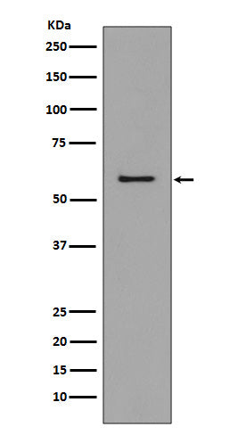 CCR3   (9I16) Rabbit Monoclonal Antibody