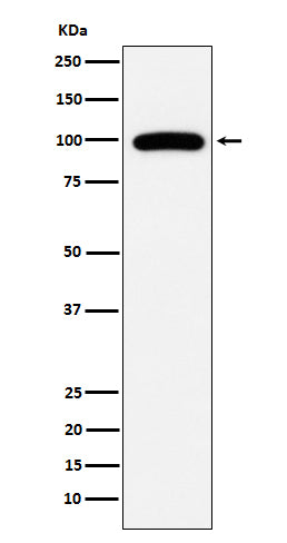 CD10 (15I14) Rabbit Monoclonal Antibody