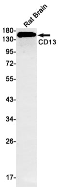 CD13 (14U5) Rabbit Monoclonal Antibody