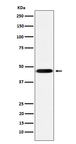 CD16 (5E1) Rabbit Monoclonal Antibody