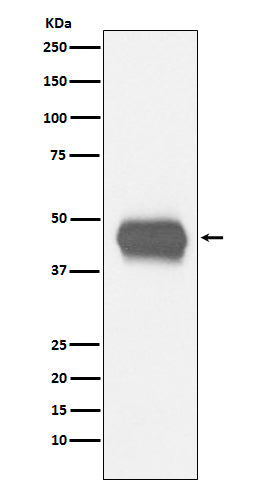 CD1a (11L3) Rabbit Monoclonal Antibody