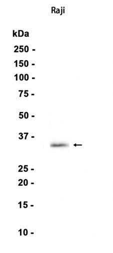 CD20 (18I8) Rabbit Monoclonal Antibody