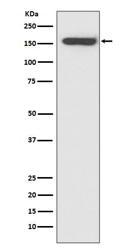 CD21 (14S6) Rabbit Monoclonal Antibody
