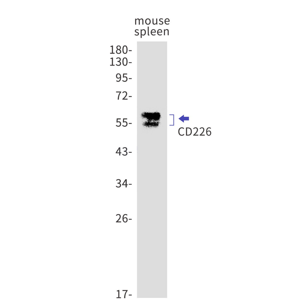 CD226 (7Z13) Rabbit Monoclonal Antibody