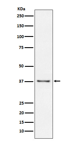 CD23 (17L19) Rabbit Monoclonal Antibody