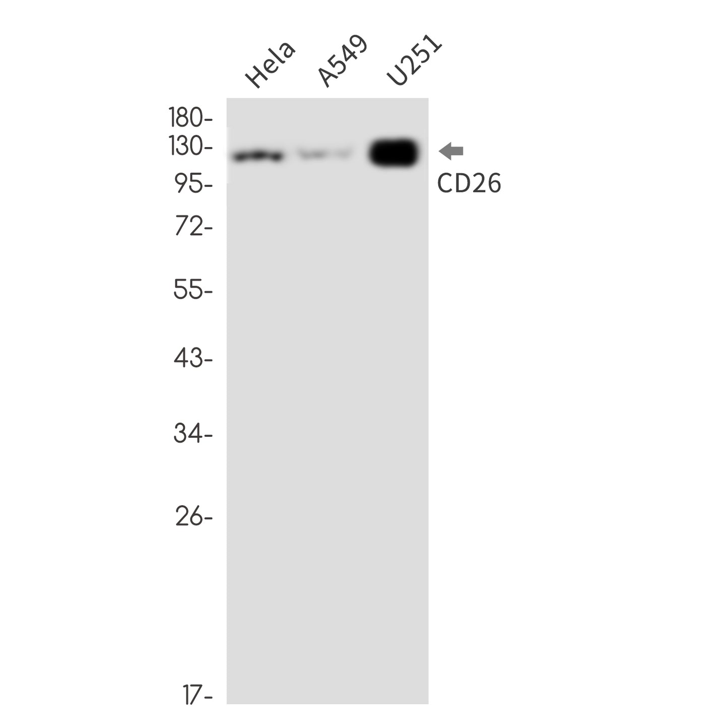 CD26 (3D8) Rabbit Monoclonal Antibody