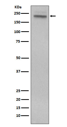 CD45  (15N7) Rabbit Monoclonal Antibody