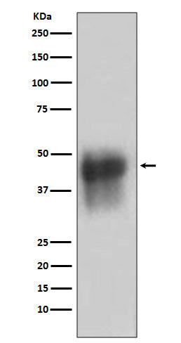 CD46 (12M15) Rabbit Monoclonal Antibody