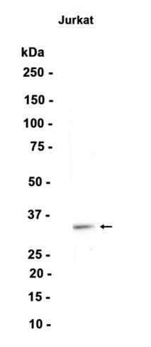 CD74 (7D14) Rabbit Monoclonal Antibody