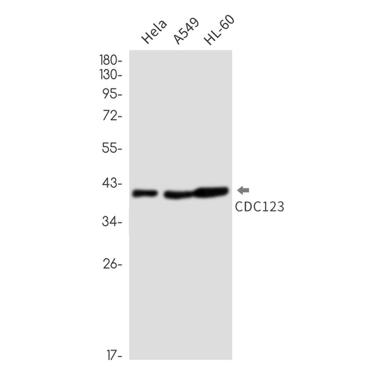 CDC123 (15X2) Rabbit Monoclonal Antibody