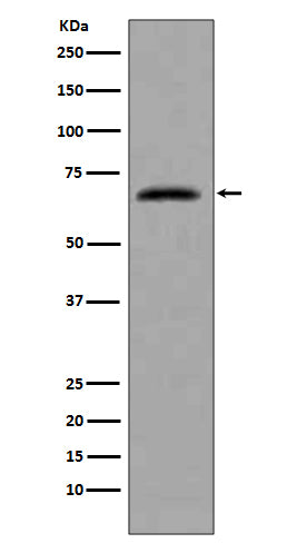 CDC7  (17K15) Rabbit Monoclonal Antibody
