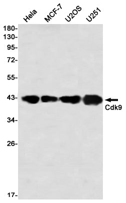 CDK9 (5L11) Rabbit Monoclonal Antibody
