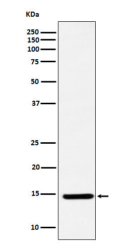 CDKN2A/p14ARF (18X15) Rabbit Monoclonal Antibody