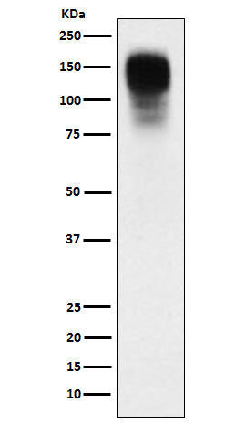 CEACAM1 (1W1) Rabbit Monoclonal Antibody