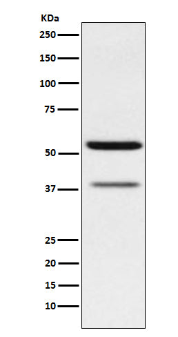 CEACAM6 (1P7) Rabbit Monoclonal Antibody