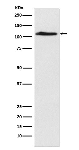 CHD1L (17T3) Rabbit Monoclonal Antibody