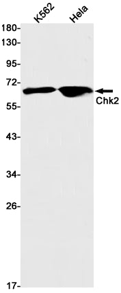 Chk2 (11S16) Rabbit Monoclonal Antibody