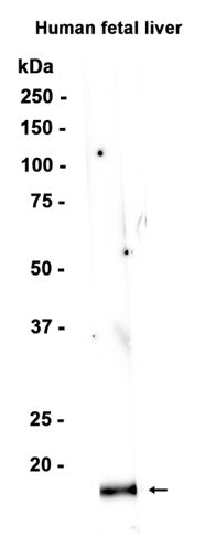 Claudin 1 (5F6) Rabbit Monoclonal Antibody