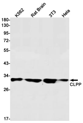 CLPP (1P6) Rabbit Monoclonal Antibody