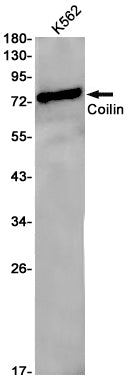 Coilin (15N1) Rabbit Monoclonal Antibody
