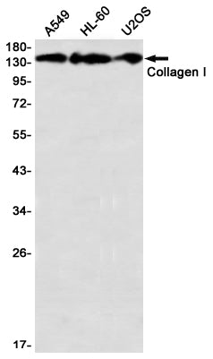 Collagen I alpha 1 (15S16) Rabbit Monoclonal Antibody