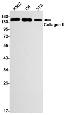 Collagen III (16I18) Rabbit Monoclonal Antibody
