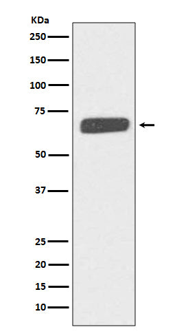 Collagen X (16Y7) Rabbit Monoclonal Antibody