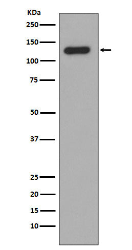 Collagen XVII (5G9) Rabbit Monoclonal Antibody