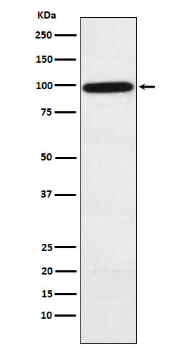 Complement factor B (5X5) Rabbit Monoclonal Antibody