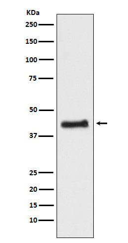 COUP TF1 (17W3) Rabbit Monoclonal Antibody