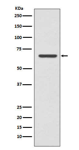 CPT2 (2S12) Rabbit Monoclonal Antibody