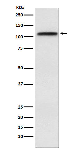 CRM1 (4C10) Rabbit Monoclonal Antibody