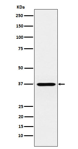 CRX (13O19) Rabbit Monoclonal Antibody