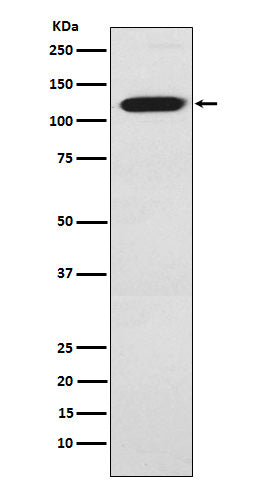 Ctip1 (6S12) Rabbit Monoclonal Antibody