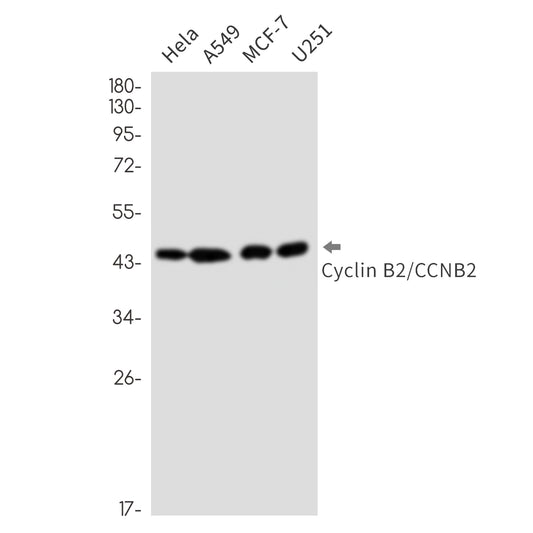 Cyclin B2 (18U13) Rabbit Monoclonal Antibody