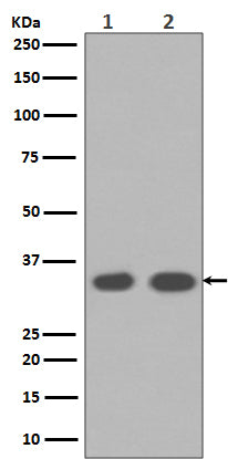 Cyclin D1 (10Z18) Rabbit Monoclonal Antibody
