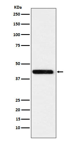 Cystathionase (2V17) Rabbit Monoclonal Antibody