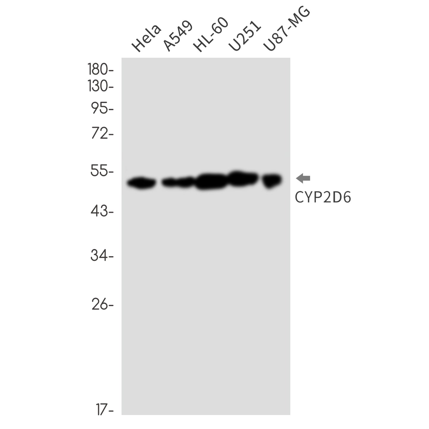 Cytochrome P450 2D6 (9F17) Rabbit Monoclonal Antibody