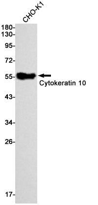 Cytokeratin 10 (7W9) Rabbit Monoclonal Antibody