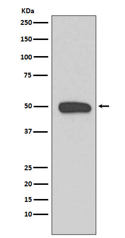 Cytokeratin 13 (15D13) Rabbit Monoclonal Antibody