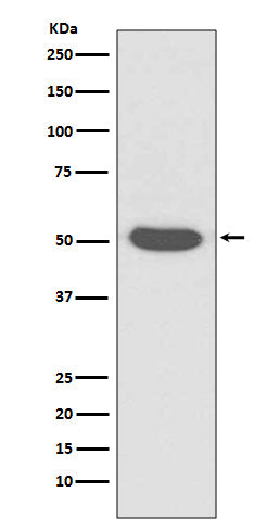 Cytokeratin 14 (11A9) Rabbit Monoclonal Antibody