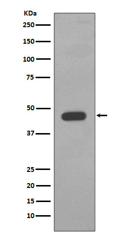 Cytokeratin 14 (18K1) Rabbit Monoclonal Antibody