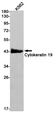 Cytokeratin 19  (8L9) Rabbit Monoclonal Antibody